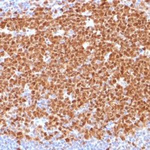 Formalin-fixed paraffin-embedded human Tonsil stained with MCM7 Mouse Monoclonal Antibody (MCM7/1468).