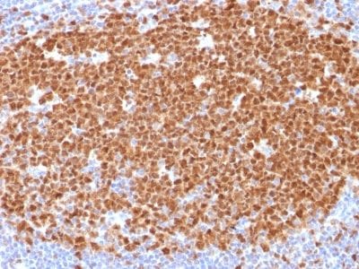 Formalin-fixed paraffin-embedded human Tonsil stained with MCM7 Mouse Monoclonal Antibody (MCM7/1468).