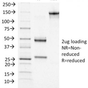 SDS-PAGE Analysis Purified BRCA1 Mouse Monoclonal Antibody (BRCA1/1472). Confirmation of Purity and Integrity of Antibody.
