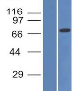 Western Blot Analysis (A) Recombinant Protein (B) HepG2 Cell lysate bcl-6 Mouse Monoclonal Antibody (BCL6/1475).