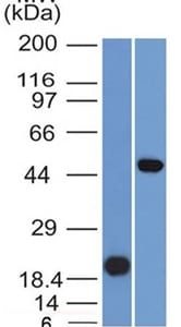 Western Blot Analysis (A) Recombinant Protein (B) Raji Cell Lysate Using PAX8 Mouse Monoclonal Antibody (PAX8/1491).