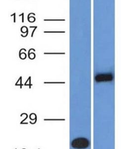 Western Blot Analysis (A) Recombinant Protein (B) Raji Cell Lysate Using PAX8 Mouse Monoclonal Antibody (PAX8/1492).