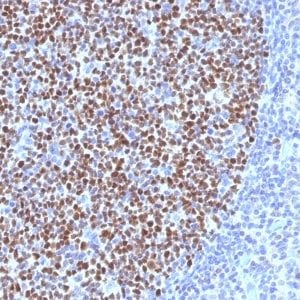 Formalin-fixed paraffin-embedded human Tonsil stained with BCL-6 Mouse Monoclonal Antibody (BCL6/1527).