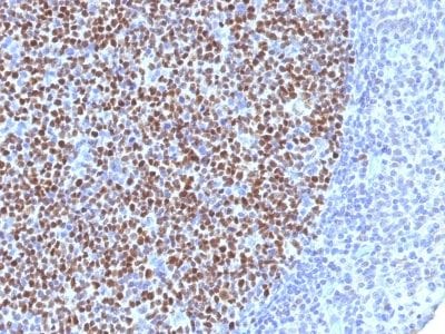 Formalin-fixed paraffin-embedded human Tonsil stained with BCL-6 Mouse Monoclonal Antibody (BCL6/1527).