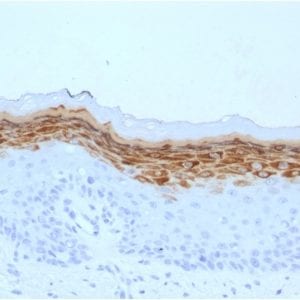 Formalin-fixed paraffin-embedded human Skin stained with Filaggrin Mouse Monoclonal Antibody (FLG/1561).