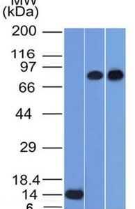 Western Blot of Recombinant PC3 and HeLa Cell Lysates using p63 Mouse Monoclonal Antibody (TP63/1786).