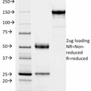 SDS-PAGE Analysis Purified SOX9 Mouse Monoclonal Antibody (PCRP-SOX9-1E5).Confirmation of Purity and Integrity.