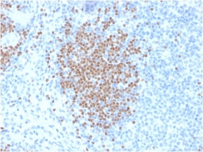 PAX5 / BSAP Monoclonal Mouse Antibody (PCRP-PAX5-1B1) - Biotium