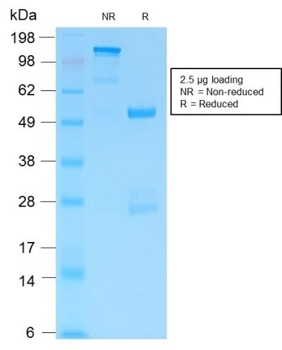 SDS-PAGE Analysis of Purified GFAP Rabbit Recombinant Monoclonal Antibody (ASTRO/1974R). Confirmation of Purity and Integrity of Antibody.