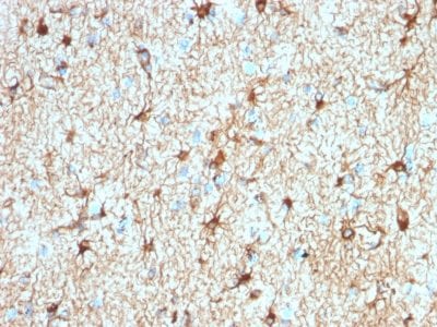 Formalin-fixed paraffin-embedded human Cerebellum stained with GFAP Rabbit Recombinant Monoclonal Antibody (ASTRO/1974R).