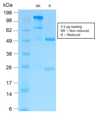SDS-PAGE Analysis of Purified MMP9 Rabbit Recombinant Monoclonal Antibody (MMP9/2025R). Confirmation of Purity and Integrity of Antibody.