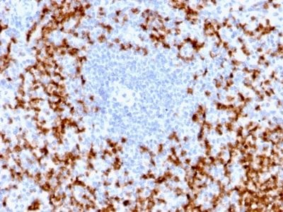 Formalin-fixed paraffin-embedded human spleen stained with MMP9 Rabbit Recombinant Monoclonal Antibody (MMP9/2025R).