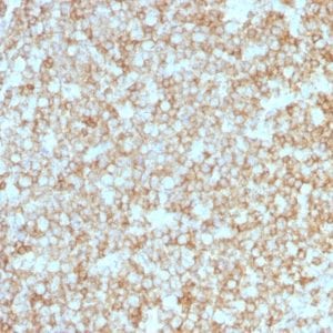Formalin-fixed paraffin-embedded human Tonsil stained with CD45 Recombinant Rabbit Monoclonal Antibody (PTPRC/1783R + PTPRC/1975R).