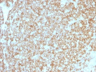 Formalin-fixed paraffin-embedded human Tonsil stained with CD45 Recombinant Rabbit Monoclonal Antibody (PTPRC/1783R + PTPRC/1975R).