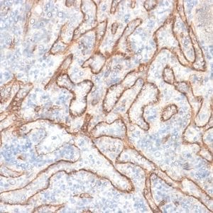 Formalin-fixed paraffin-embedded human Tonsil stained with Beta-Catenin Recombinant Rabbit Monoclonal Antibody (CTNNB1/2030R).