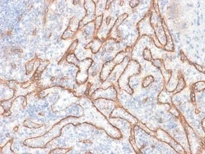 Formalin-fixed paraffin-embedded human Tonsil stained with Beta-Catenin Recombinant Rabbit Monoclonal Antibody (CTNNB1/2030R).