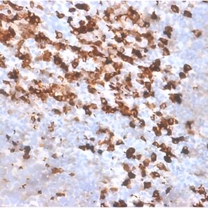 Formalin-fixed paraffin-embedded Tonsil stained with biotinylated Kappa Light Chain probe followed by anti-biotin Rabbit Recombinant Monoclonal antibody (BTN/2032R).