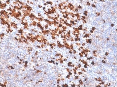 Formalin-fixed paraffin-embedded Tonsil stained with biotinylated Kappa Light Chain probe followed by anti-biotin Rabbit Recombinant Monoclonal antibody (BTN/2032R).