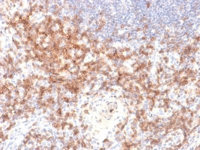 Formalin-fixed paraffin-embedded human Lymph Node stained with CD27 Rabbit Recombinant Monoclonal Antibody (LPFS2/2034R).