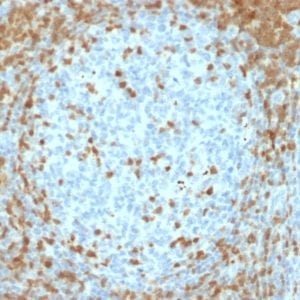 Formalin-fixed paraffin-embedded human Tonsil stained with ZAP70 Mouse Monoclonal Antibody (ZAP70/2035).