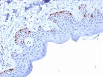 Formalin-fixed paraffin-embedded human Skin stained with gp100 Mouse Monoclonal Antibody (PMEL/2037).