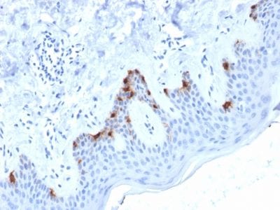 Formalin-fixed paraffin-embedded human Skin stained with gp100 Mouse Monoclonal Antibody (PMEL/2038).