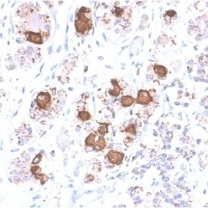 Formalin-fixed paraffin-embedded Human Pituitary stained with ACTH Rabbit Recombinant Monoclonal Antibody (CLIP/2040R).