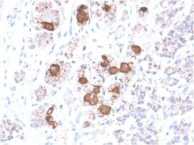 Formalin-fixed paraffin-embedded Human Pituitary stained with ACTH Rabbit Recombinant Monoclonal Antibody (CLIP/2040R).