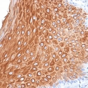 Formalin-fixed paraffin-embedded human Skin stained with Cytokeratin 16 Rabbit Recombinant Monoclonal Antibody (KRT16/2043R).