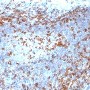 Formalin-fixed paraffin-embedded human Lymph Node stained with ZAP70 Mouse Monoclonal Antibody (ZAP70/2046).