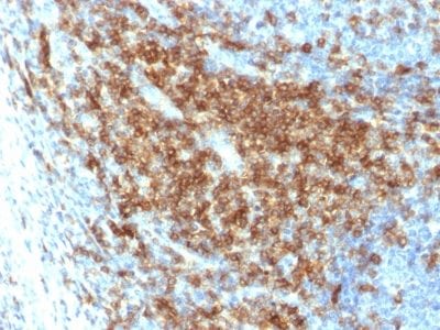 Formalin-fixed paraffin-embedded human Tonsil stained with CD43 Rabbit Recombinant Monoclonal Antibody (SPN/2049R).
