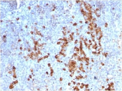 Formalin-fixed paraffin-embedded human Tonsil stained with Kappa Light Chain Mouse Recombinant Monoclonal Ab (rKLC709).
