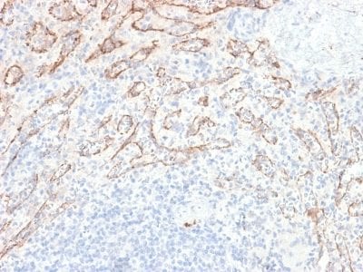 Formalin-fixed paraffin-embedded human Spleen stained with VEGI Rabbit Recombinant Monoclonal Antibody (VEGI /2052R).
