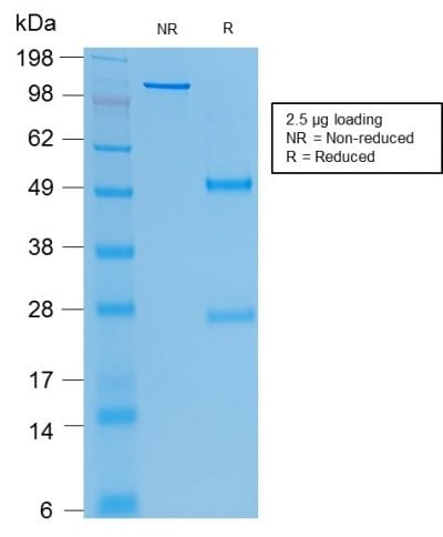 SDS-PAGE Analysis Purified CEA Mouse Recombinant Monoclonal Antibody (rC66/1009). Confirmation of Purity and Integrity of Antibody.