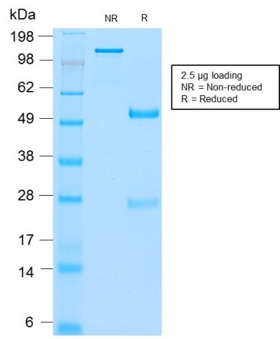 SDS-PAGE Analysis Purified CEA Rabbit Recombinant Monoclonal Antibody (C66/2055R). Confirmation of Purity and Integrity of Antibody.