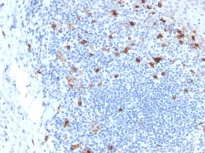 Formalin-fixed paraffin-embedded human Tonsil stained with CD103 Mouse Monoclonal Antibody (ITGAE/2063).