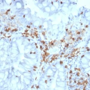 Formalin-fixed paraffin-embedded human Colon stained with CD103 Mouse Monoclonal Antibody (ITGAE/2063).