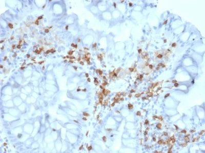 Formalin-fixed paraffin-embedded human Colon stained with CD103 Mouse Monoclonal Antibody (ITGAE/2063).