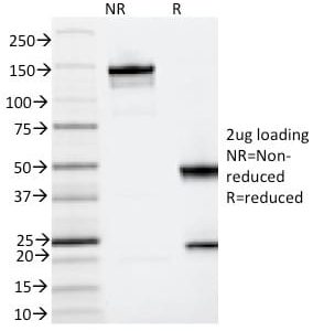 SDS-PAGE Analysis Purified CD123 Mouse Monoclonal Antibody (IL3RA/2065).Confirmation of Integrity and Purity Antibody.