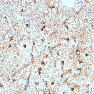Formalin-fixed paraffin-embedded human Cerebellum stained with GFAP Mouse Monoclonal Antibody (GFAP/2076).