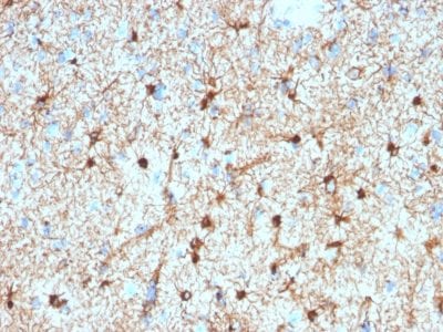 Formalin-fixed paraffin-embedded human Cerebellum stained with GFAP Mouse Monoclonal Antibody (GFAP/2076).