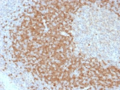 Formalin-fixed paraffin-embedded human Tonsil stained with TCL1 Mouse Monoclonal Antibody (TCL1/2078).