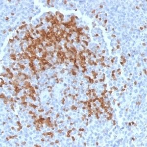 Formalin-fixed paraffin-embedded human Spleen stained with TCL1 Mouse Monoclonal Antibody (TCL1/2078).