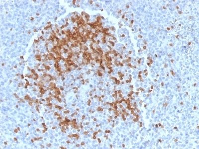 Formalin-fixed paraffin-embedded human Spleen stained with TCL1 Mouse Monoclonal Antibody (TCL1/2078).