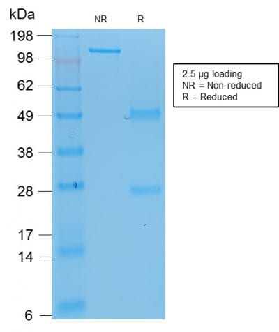 SDS-PAGE Analysis Purified p53 Mouse Recombinant Monoclonal Antibody (rBP53-12). Confirmation of Purity and Integrity of Antibody