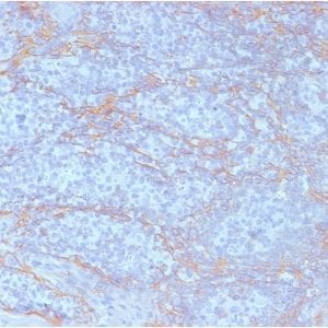 Formalin-fixed paraffin-embedded human Tonsil stained with Catenin beta Mouse Monoclonal Antibody (CTNNB1/2098).
