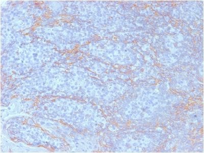 Formalin-fixed paraffin-embedded human Tonsil stained with Catenin beta Mouse Monoclonal Antibody (CTNNB1/2098).