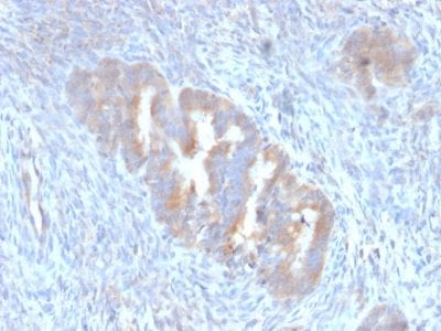 Formalin-fixed paraffin-embedded human Endometrium stained with ATG5 Mouse Monoclonal Antibody (ATG5/2101).