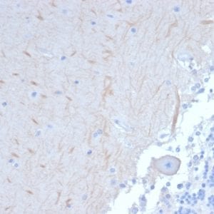 Formalin-fixed paraffin-embedded human Brain stained with ATG5 Mouse Monoclonal Antibody (ATG5/2101).