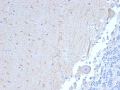 Formalin-fixed paraffin-embedded human Brain stained with ATG5 Mouse Monoclonal Antibody (ATG5/2101).